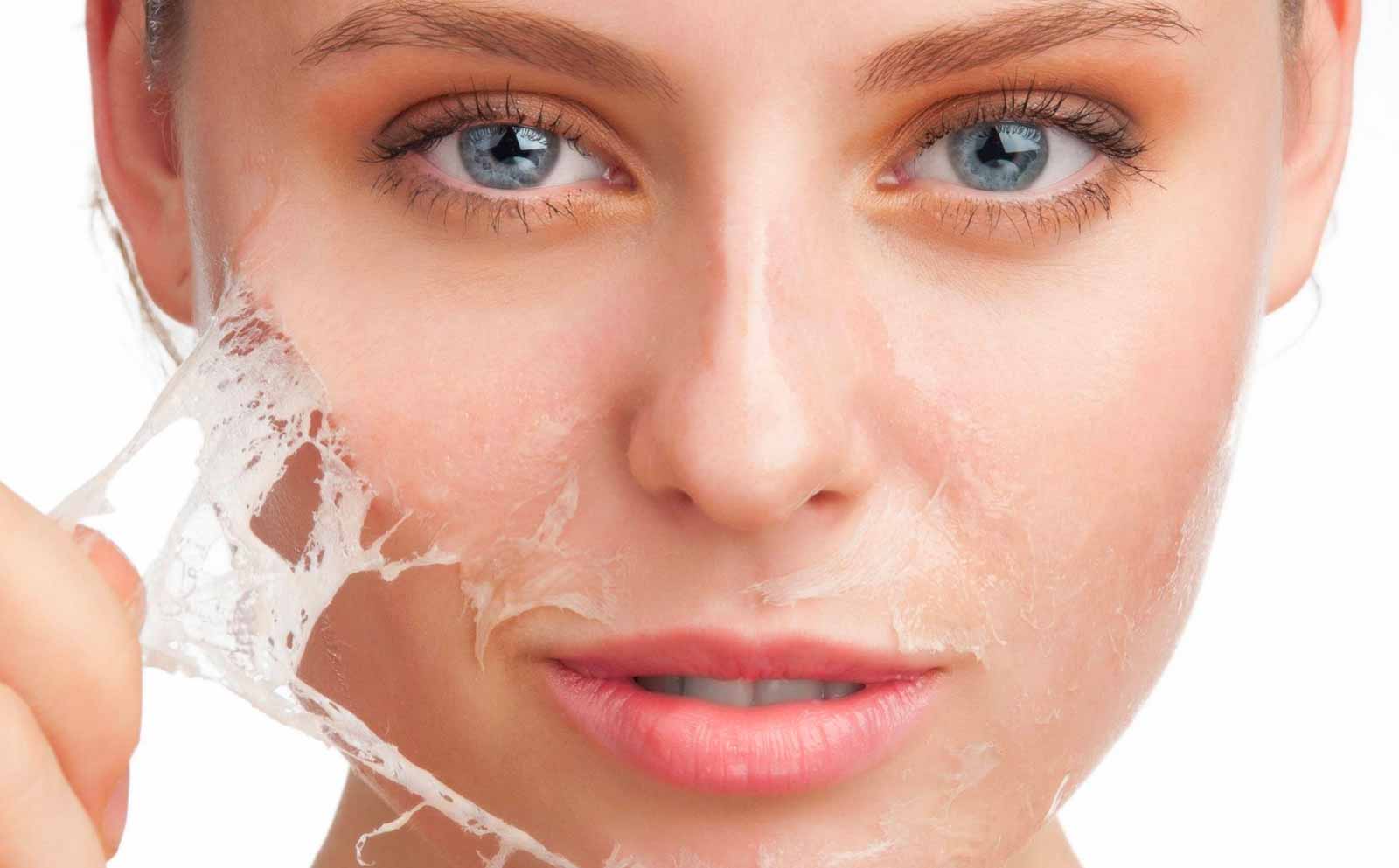 Chemical Peels